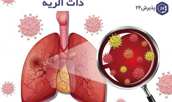 عکس بیماری ذات ریه