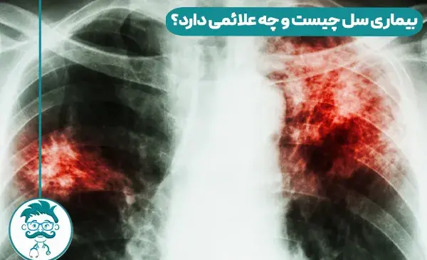 عکس ریه درگیر سل
