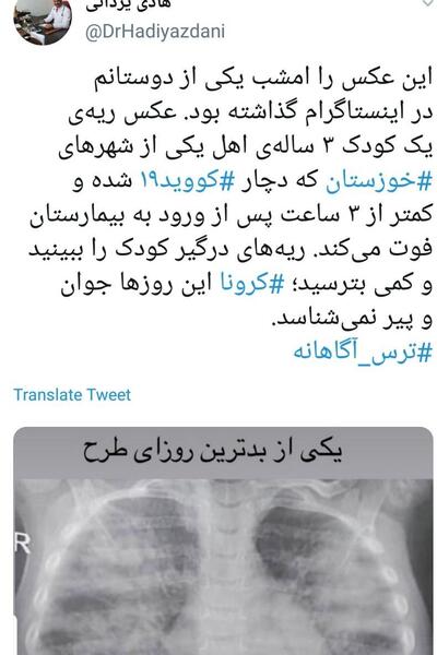 عکس ریه درگیر نوزاد
