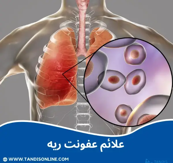 عکس درگیری ریه