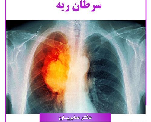 عکس جواب آزمایش سرطان ریه