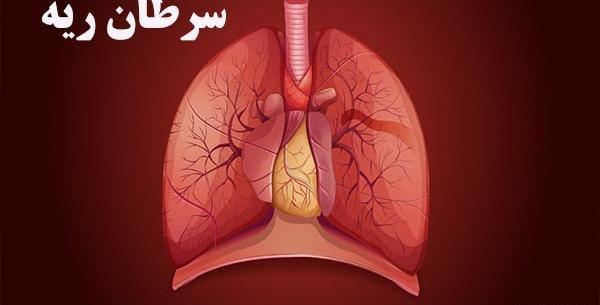 عکس جواب آزمایش سرطان ریه