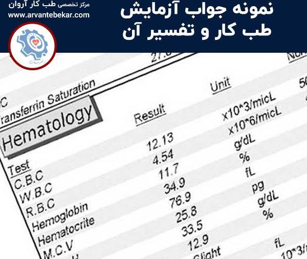 عکس جواب آزمایش سرطان ریه