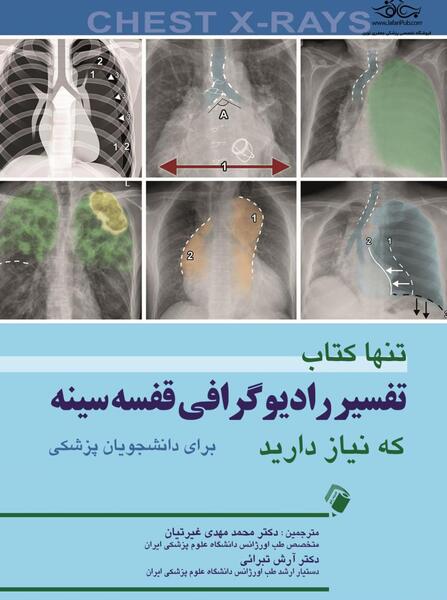 تحلیل عکس رادیولوژی ریه