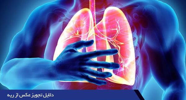 عکس سی تی اسکن ریه سالم و ناسالم