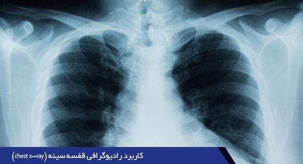 عکس رادیولوژی ریه نرمال