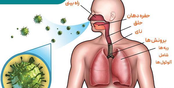 عکس ریه عفونی کودکان
