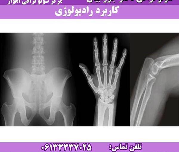 عکس ریه داخل بدن