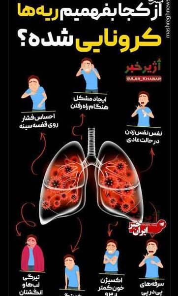 عکس ریه ادم معتاد