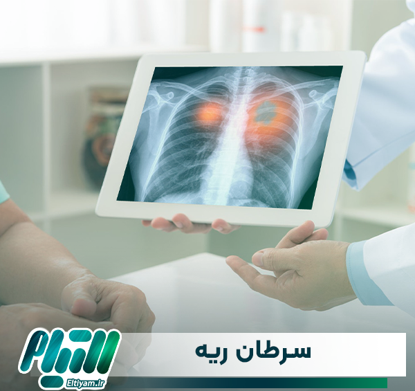 عکس رادیولوژی ریه سالم و سیگاری