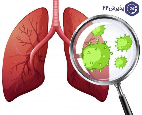 عکس از ریه انسان