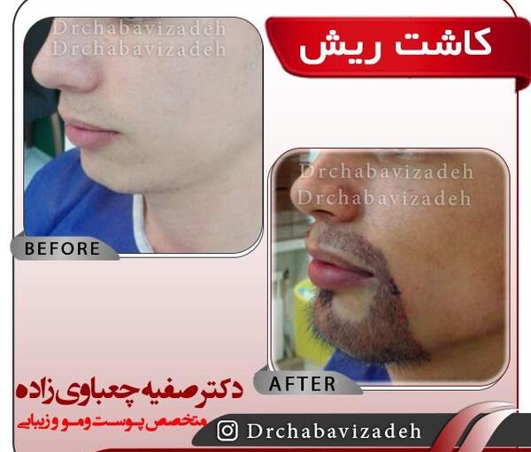 ریش و سبیل گذاشتن رو عکس