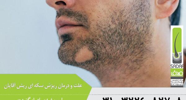 عکس ریزش سکه ای ریش
