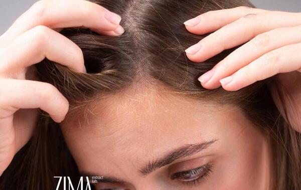 عکس ریزش مو از ریشه
