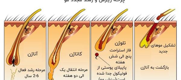 عکس ریزش مو از ریشه