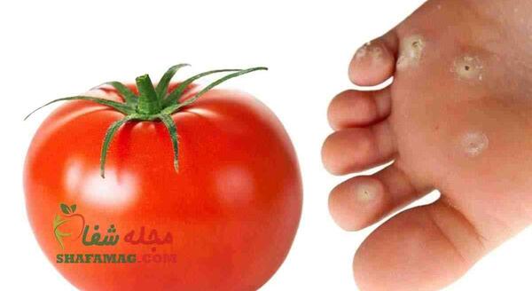 گوجه فرنگي عکس ریشه میخچه پا
