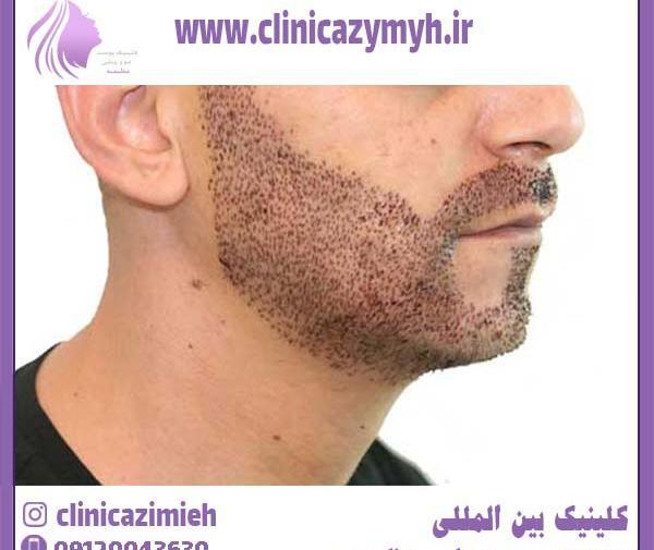 عکس ریش و سبیل پرپشت