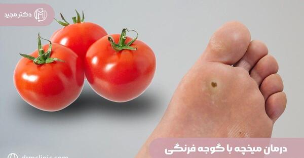 عکس ریشه های میخچه