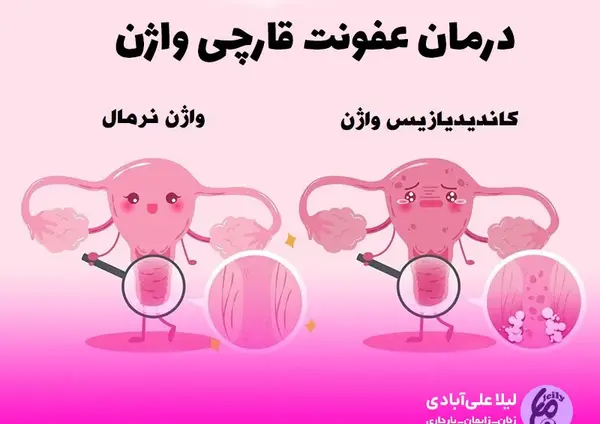 عکس شیاف سیاه دانه و عسل