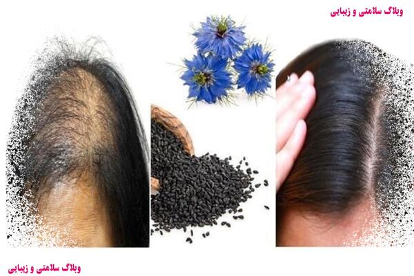 عکس روغن سیاه دانه برای مو