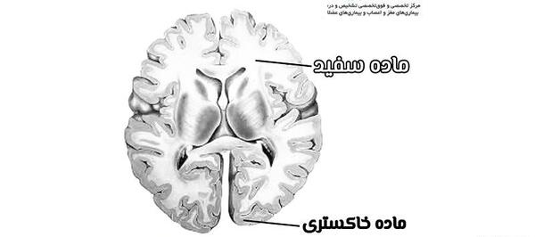 عکس سیاه سفید قلب و مغز