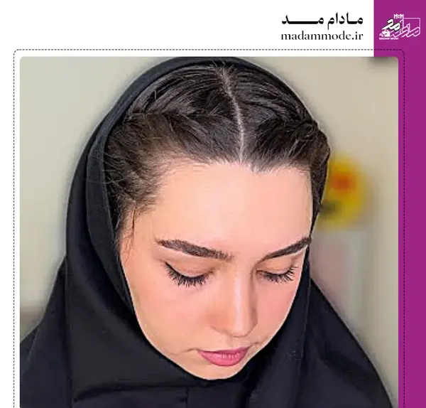 عکس موی سوسکی
