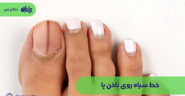 عکس ناخن سیاه شده