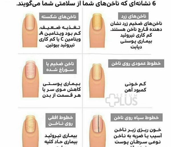 عکس ناخن شکسته شده