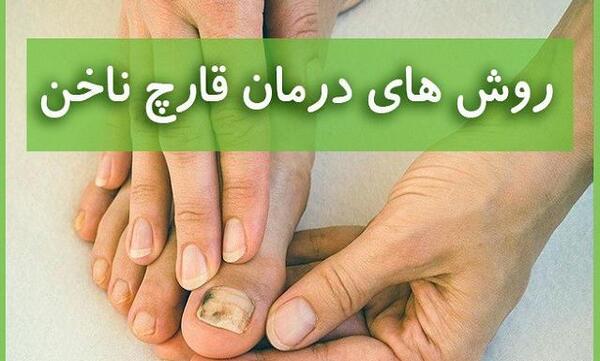 عکس عفونت قارچی ناخن