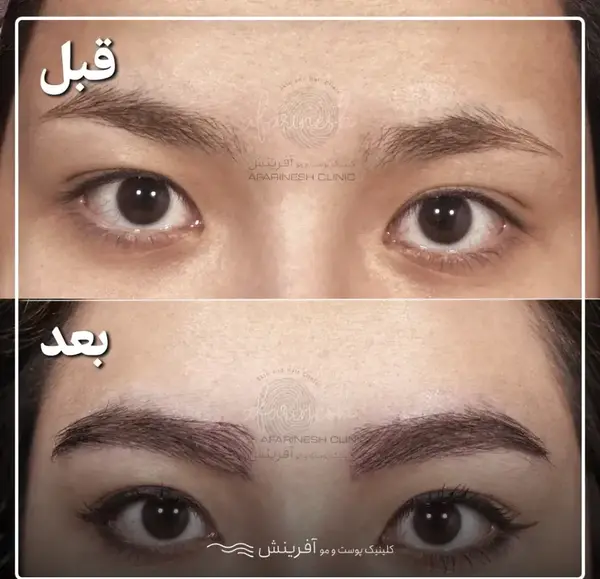 عکس چشم ابرو مردانه