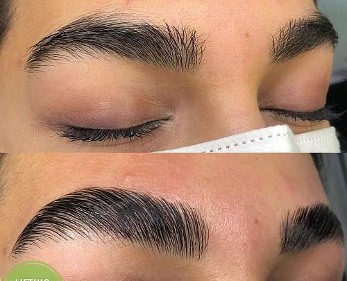 عکس لیفت ابرو مردانه