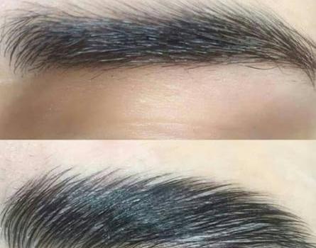 عکس لیفت ابرو مردانه
