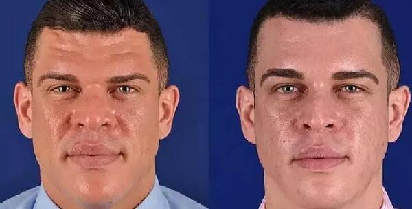 عکس لیفت ابرو مردانه