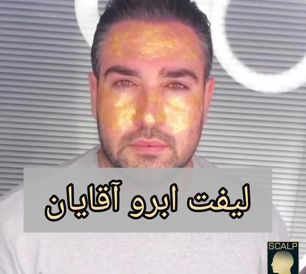 عکس لیفت ابرو مردانه