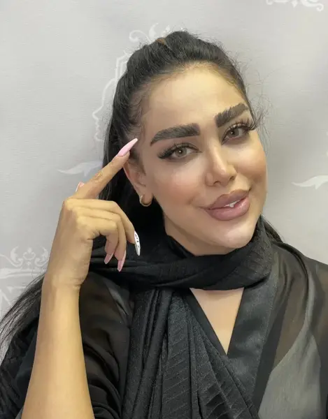 عکس لیفت ابرو مردانه