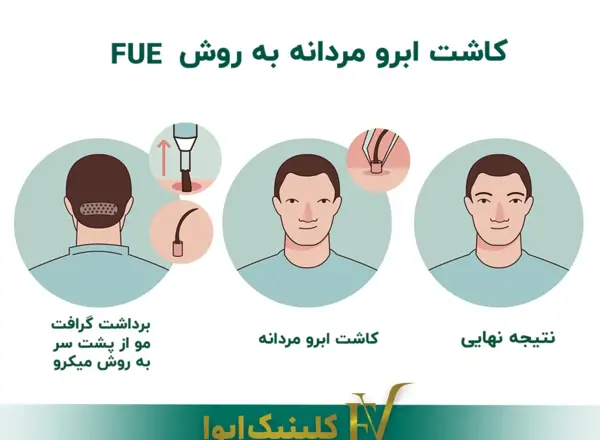 عکس کاشت ابرو مردانه
