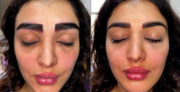 عکس کاشت ابرو مردانه
