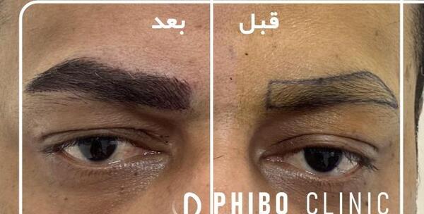 عکس کاشت ابرو مردانه