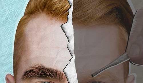 عکس کاشت ابرو مردانه
