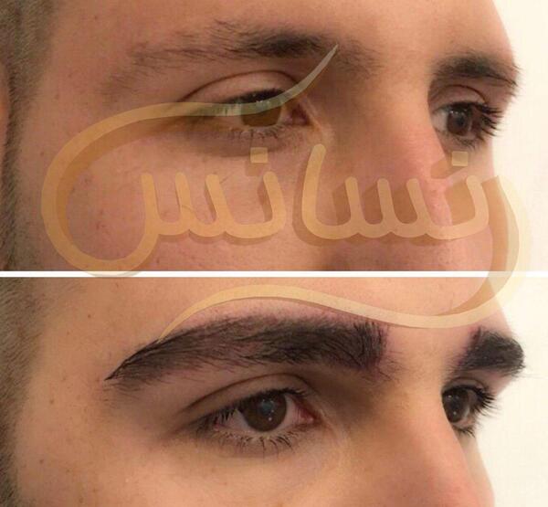 عکس کاشت ابرو مردانه