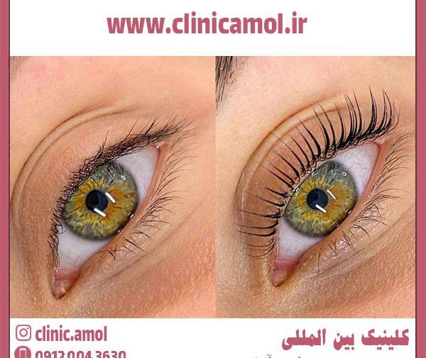 عکس هاشور ابرو مردانه
