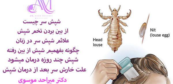 عکس تخم شپش سر