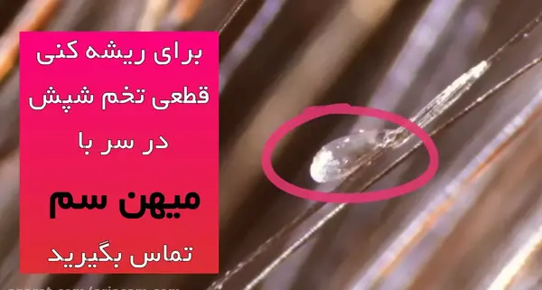 عکس شپش تخم گذار