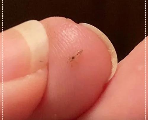 عکس شپش تخم گذار