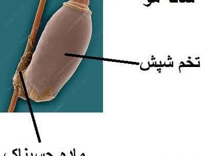 عکس تخم شپش در مو