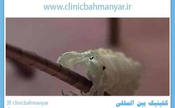 عکس شپش واقعی در مو