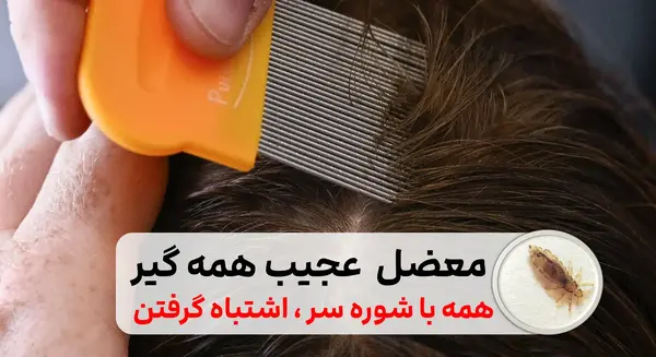 عکس واقعی شپش سر