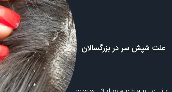عکس شپش روی مژه