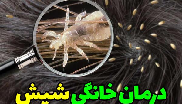عکس های کارتونی شپش