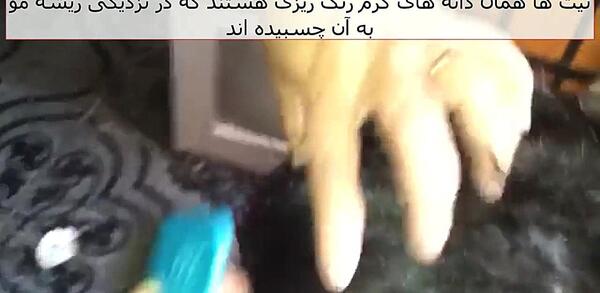 عکس و فیلم شپش